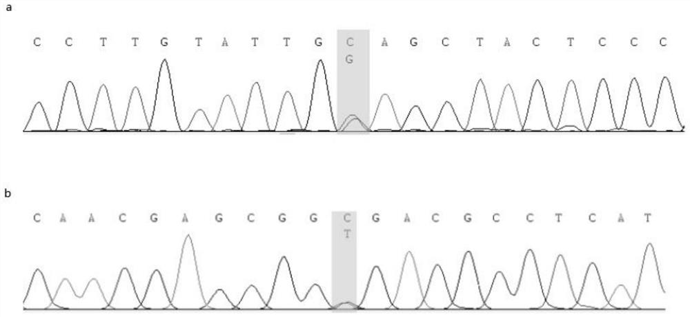 Primer group and kit for detecting osteogenesis insufficiency related genes based on multiple PCR (Polymerase Chain Reaction) and high-throughput sequencing technology and application of primer group and kit