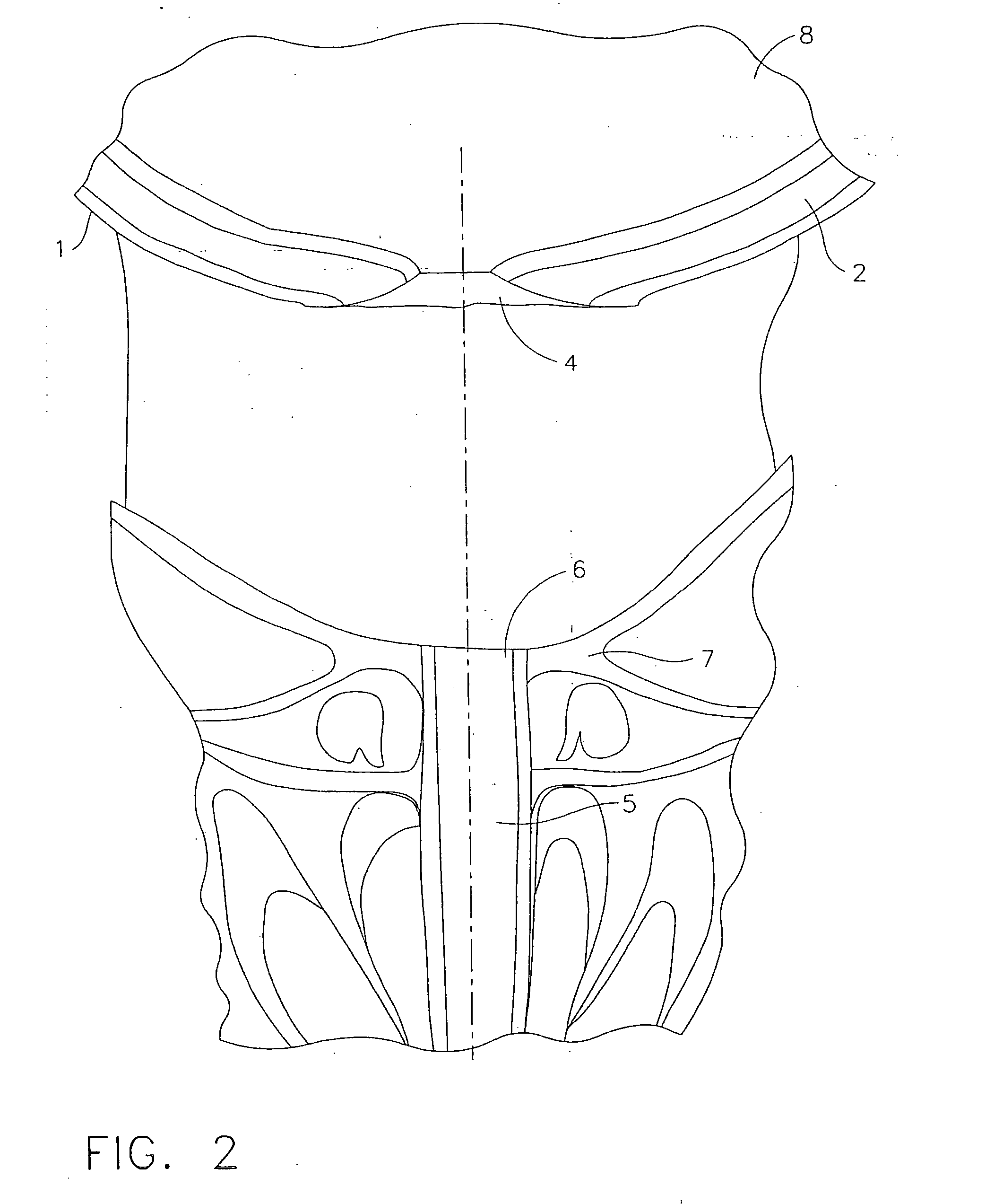 Method and instrument for effecting anastomosis of respective tissues defining two body lumens