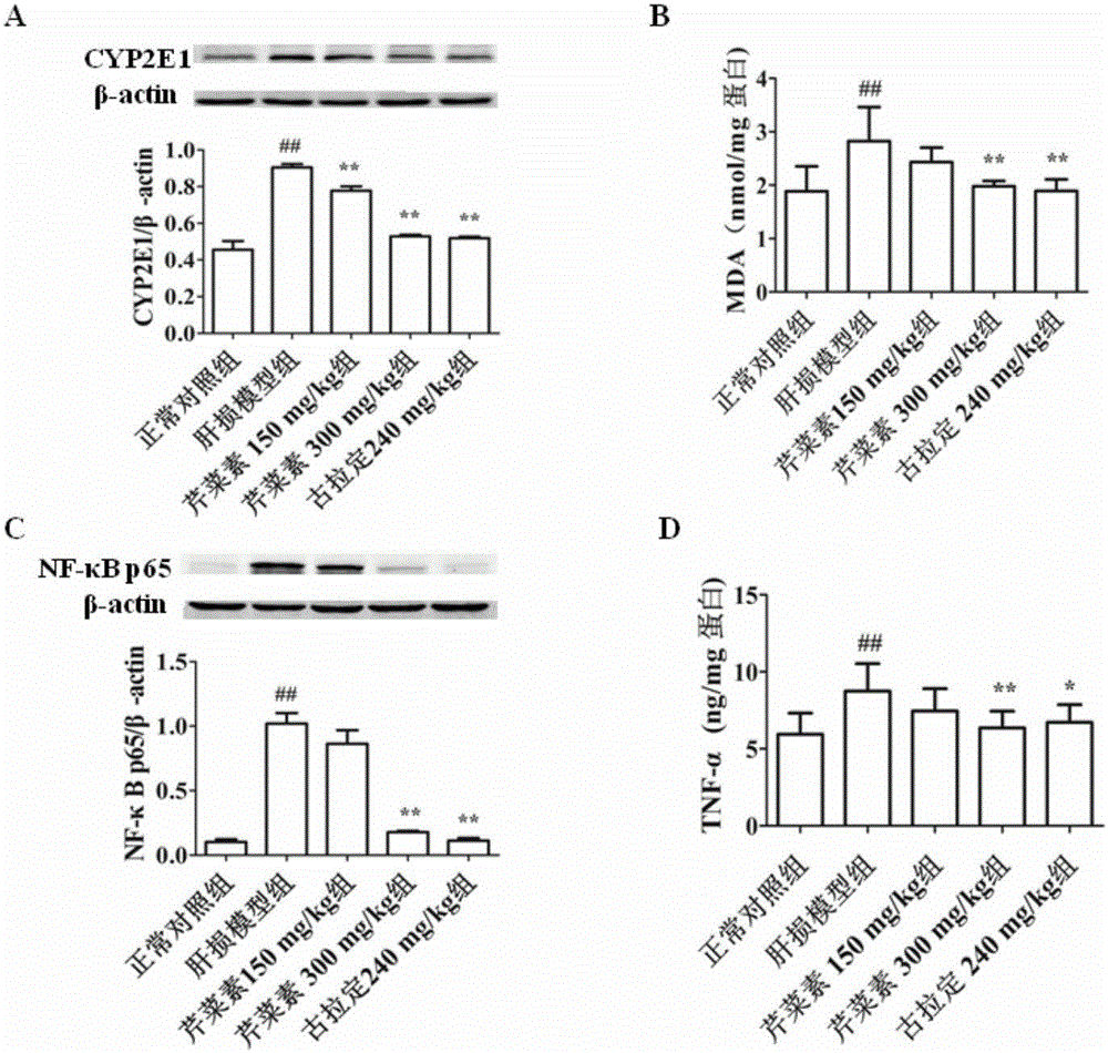 Application of apigenin in preparing medicines or health care foods for preventing and/or treating alcoholic liver injury