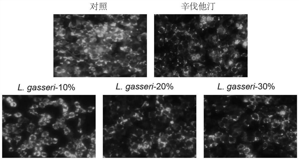 Lactobacillus gasseri having the function of preventing and treating hyperlipidemia, its product composition and its preparation method and application