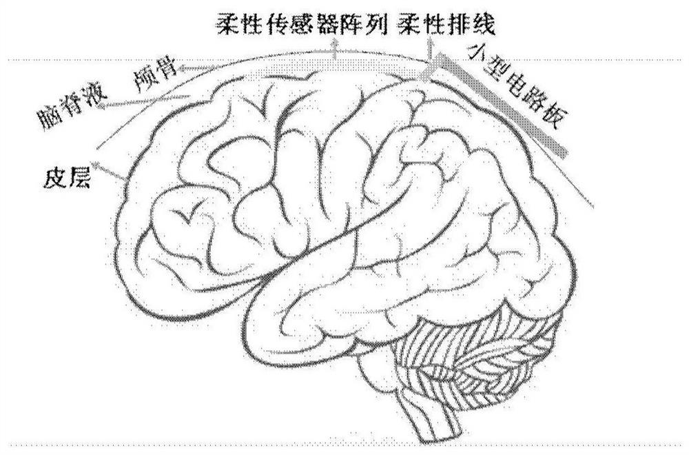 Circuit system of multi-mode sensor for acquiring intracranial physiological and biochemical information