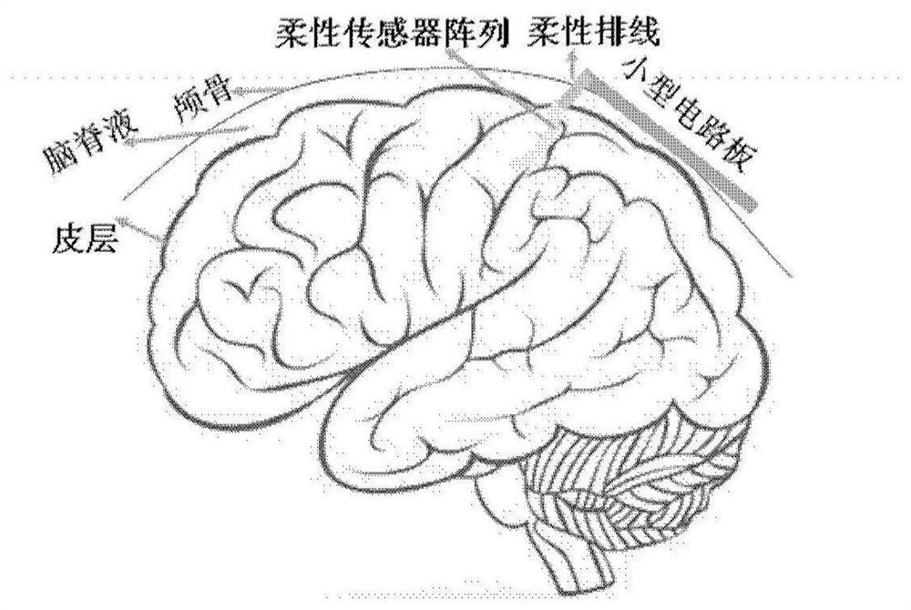 Circuit system of multi-mode sensor for acquiring intracranial physiological and biochemical information