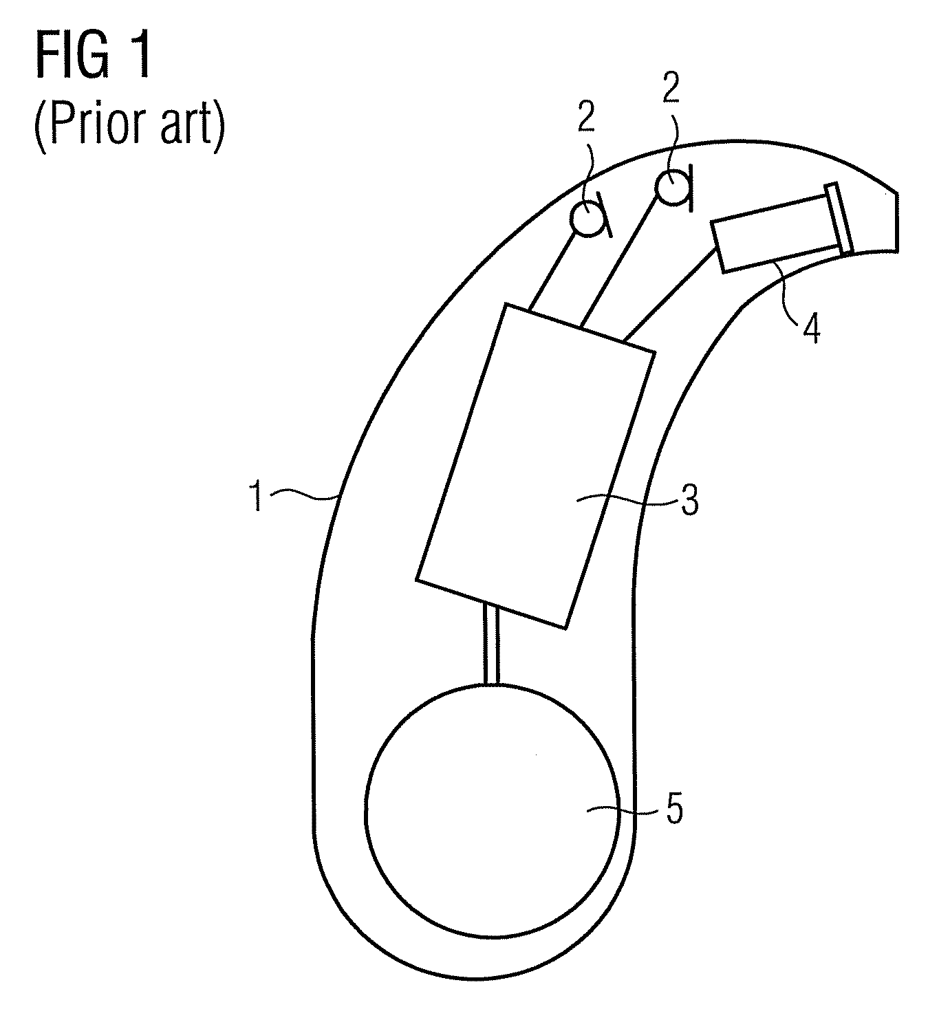 Filter bank system for hearing aids