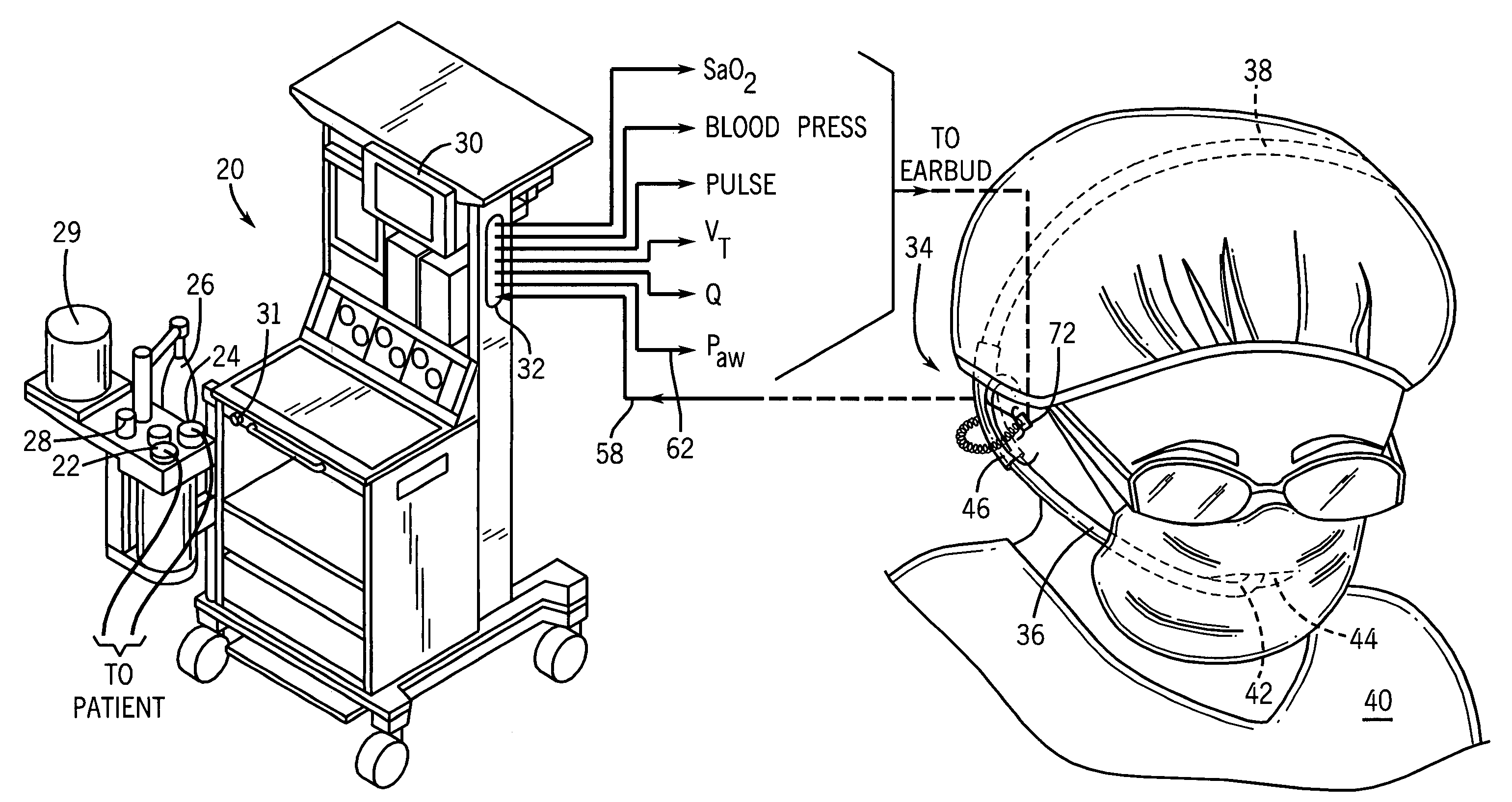 Arrangement and method for controlling operational characteristics of medical equipment