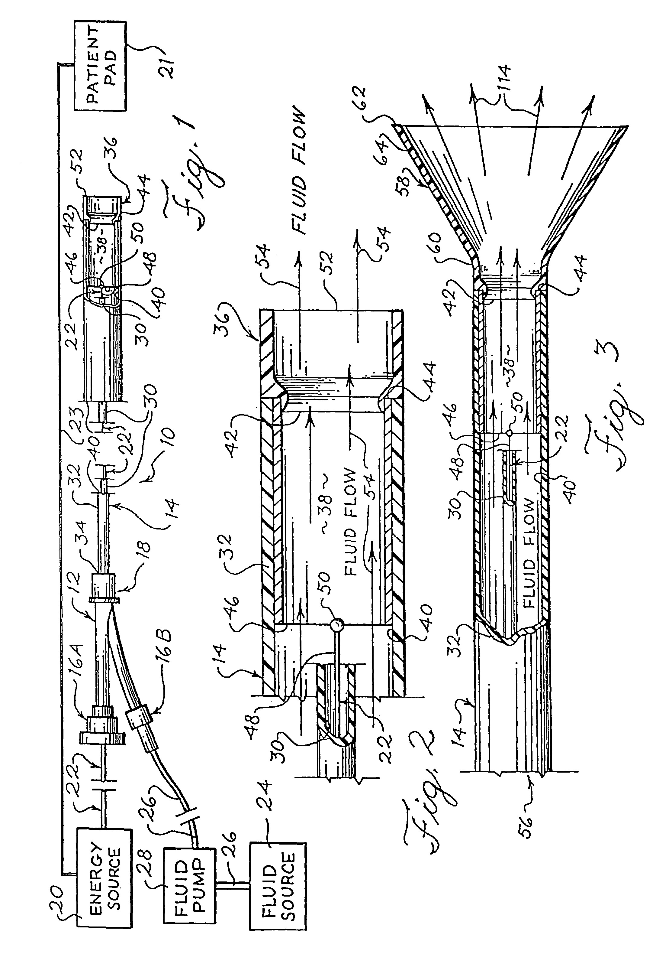 Electrophysiology energy treatment devices and methods of use