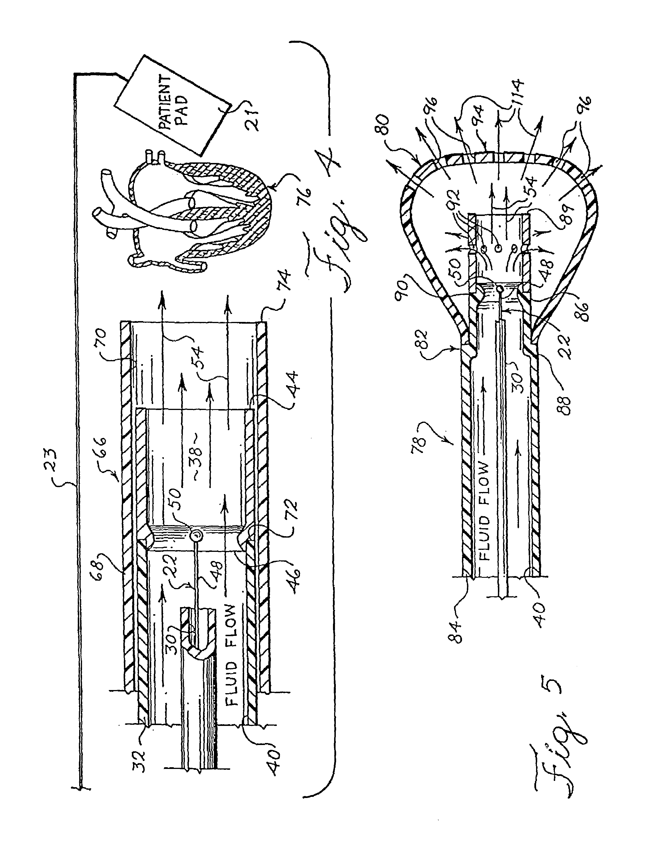 Electrophysiology energy treatment devices and methods of use