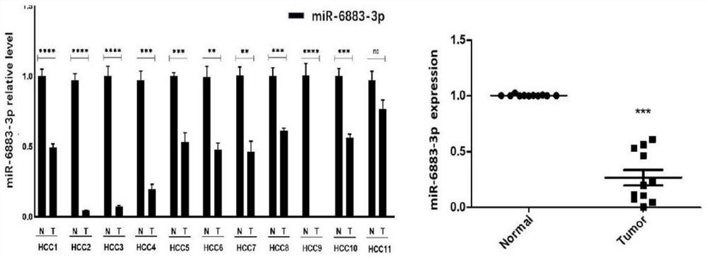 Application of miR-6883-3p in preparation of anti-liver cancer or liver cancer prognosis evaluation product