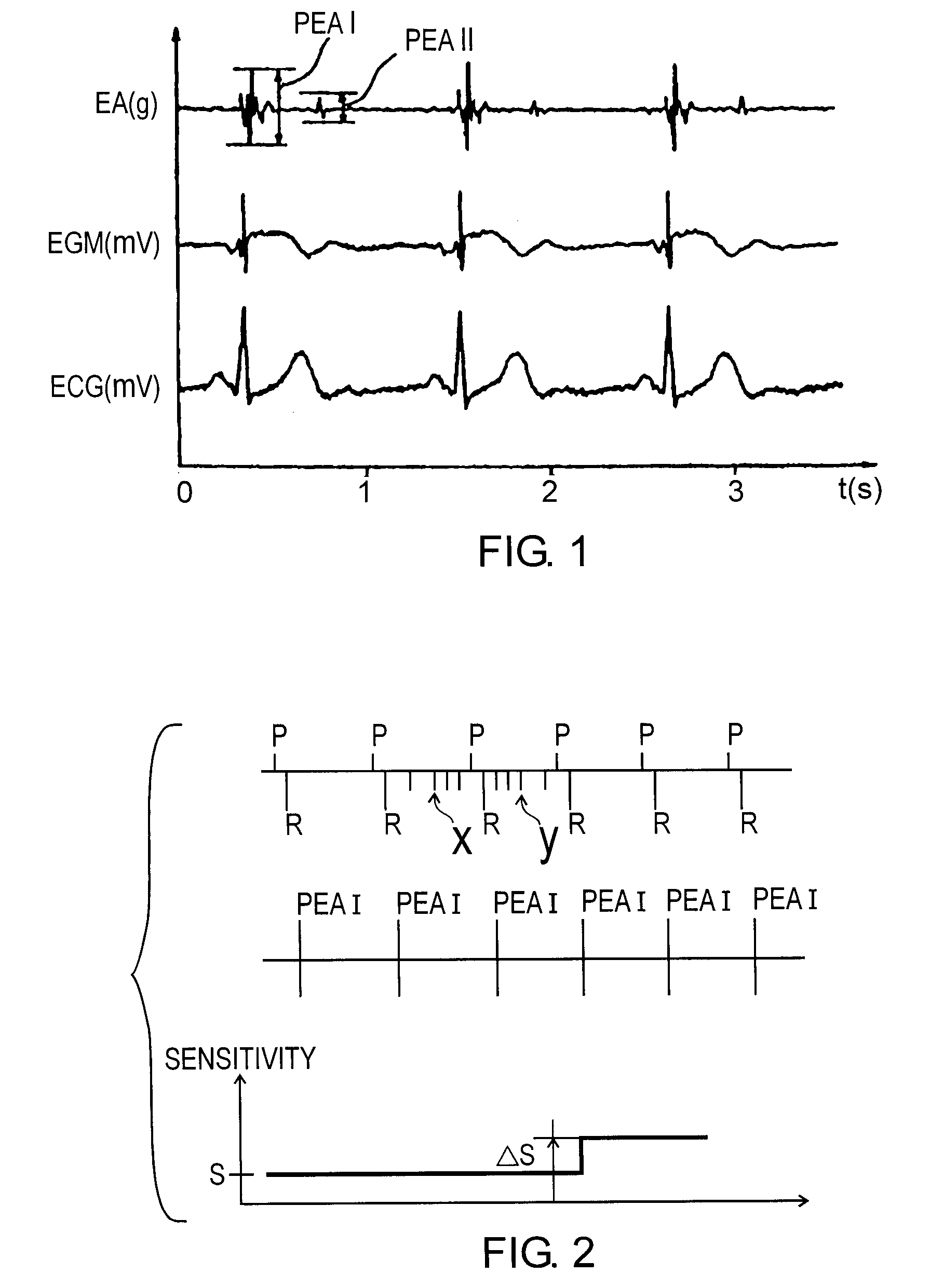 Detecting ventricular noise artifacts in an active implantable medical device for pacing, resynchronization and/or defibrillation of the heart
