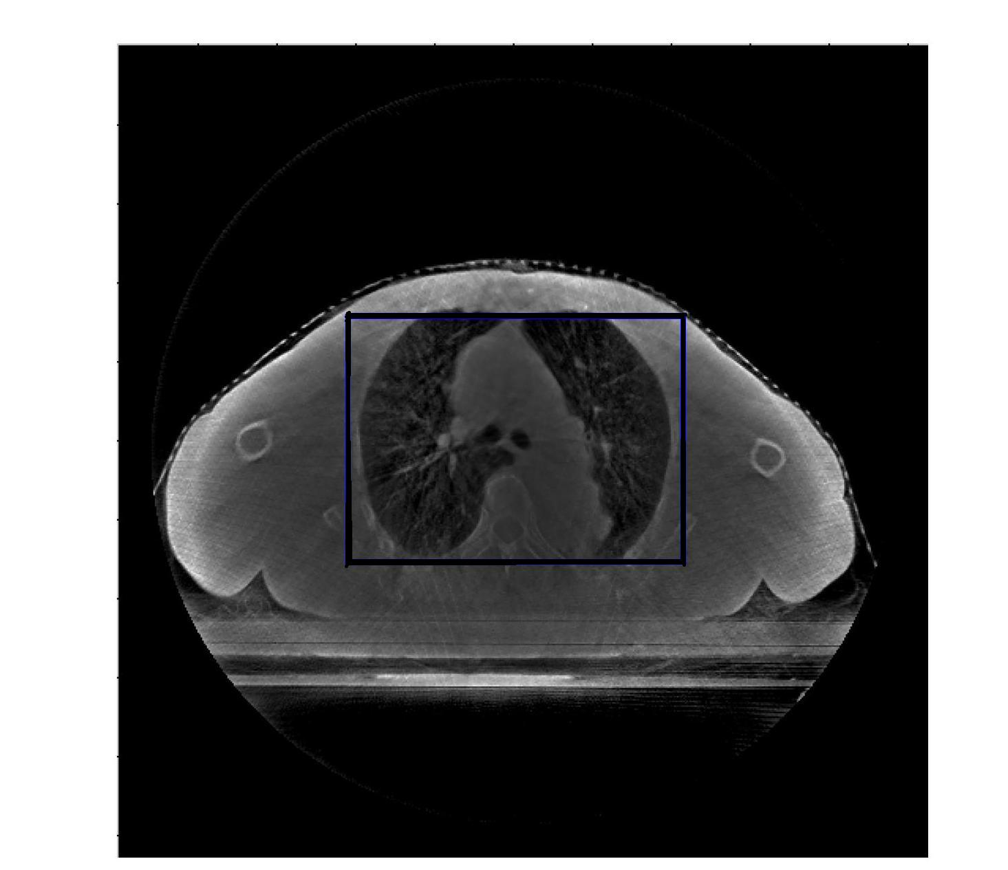 Method for reconstructing sparse degree CT (Computed Tomography) image