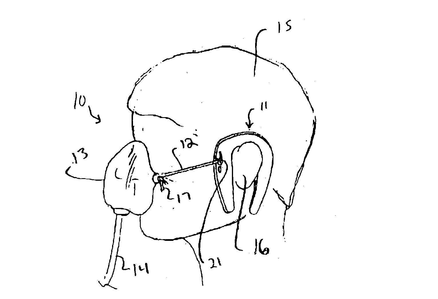 Oxygen mask retention device and method for retaining an oxygen mask
