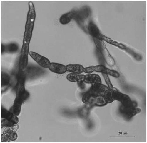 Tissue culture method for obtaining kelp filaments and application of tissue culture method