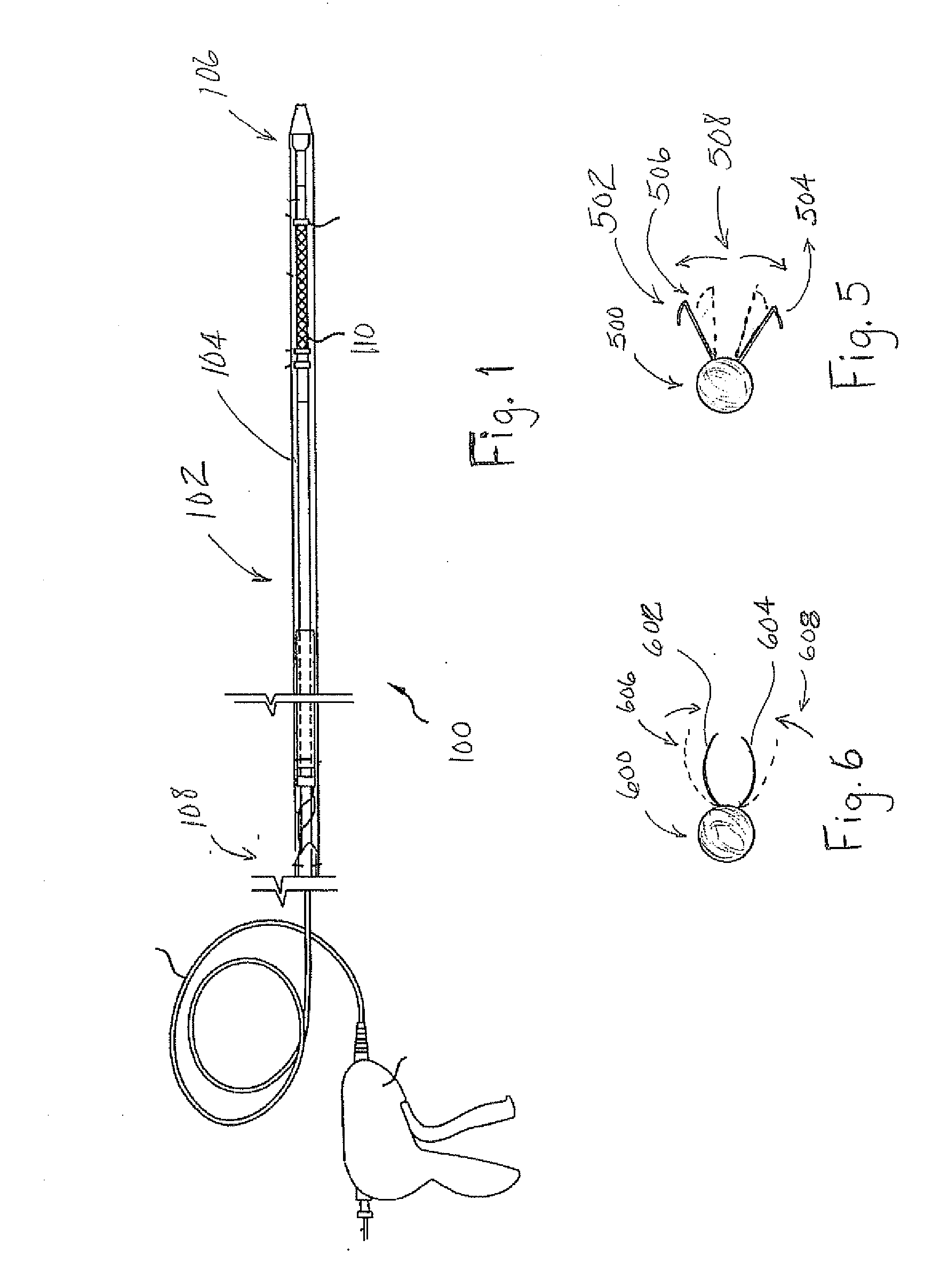 Stent based method and apparatus for directing external beam radiation therapy