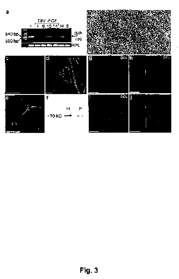 Use of compounds having gip activity for the treatment of disorders associated with abnormal loss of cells and/or for the treatment of obesity