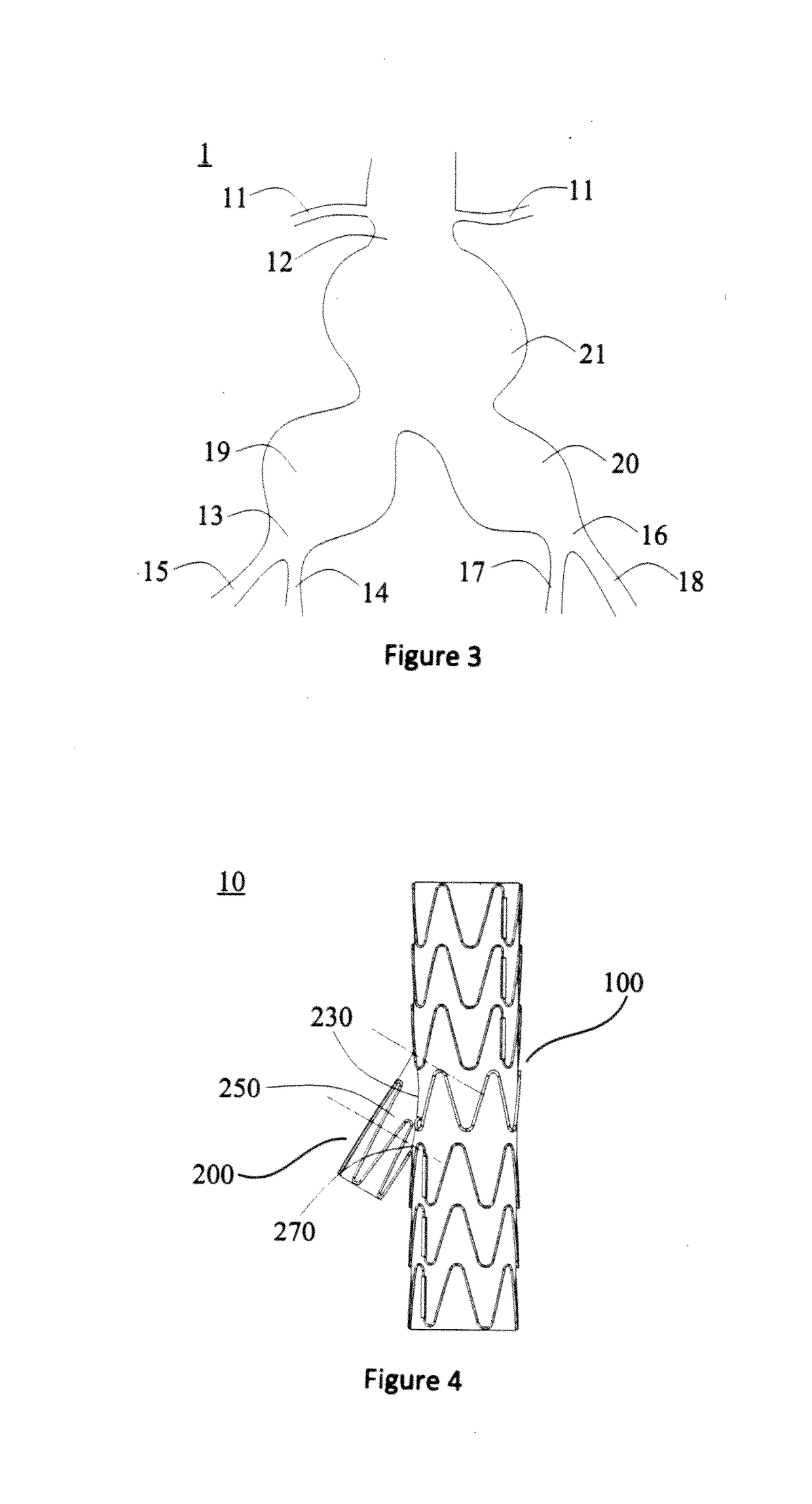 Fork-Type Covered Stent