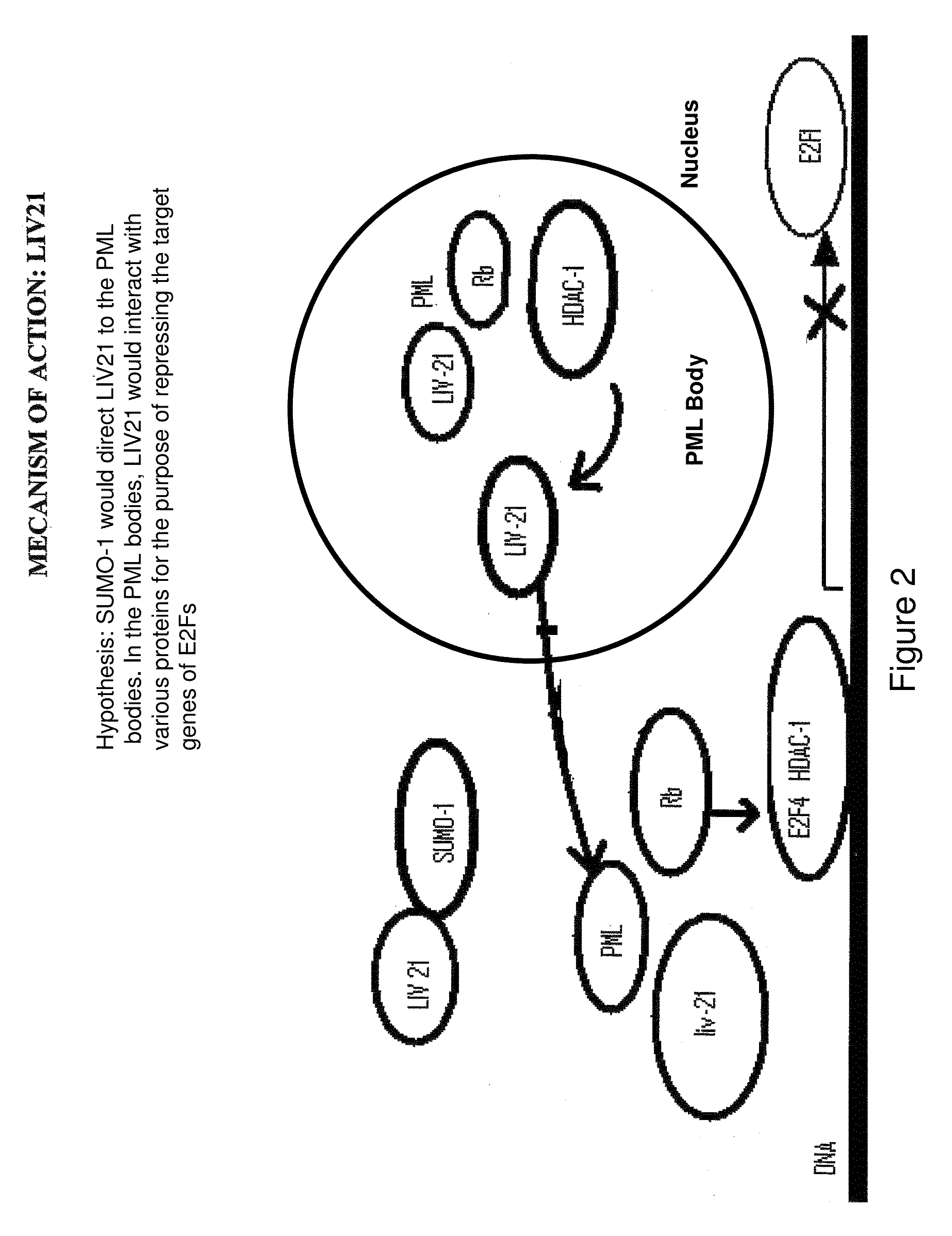 Diagnosis method and treatment for cancer using liv21 proteins and E2F1/E2F4 biomarkers