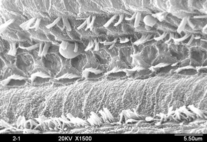 A preparation method of a pharmaceutical composition for treating deafness