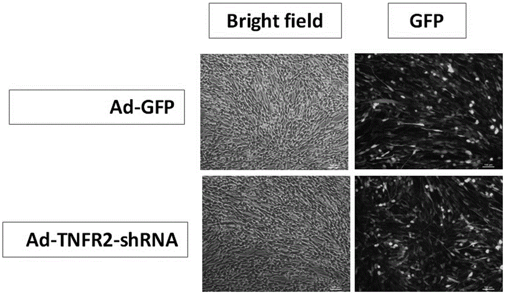 Recombined Ad-TNFR2 shRNA adenoviridae and construction and application thereof