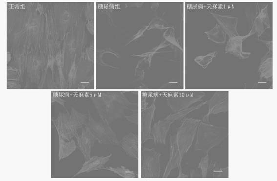 Application of gastrodin in the use of titanium metal in traditional Chinese medicine in diabetic environment