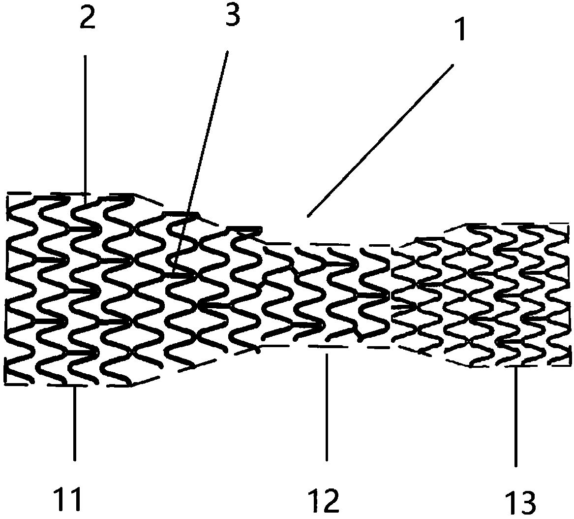 Expandable stent with variable-diameter sacculus for children