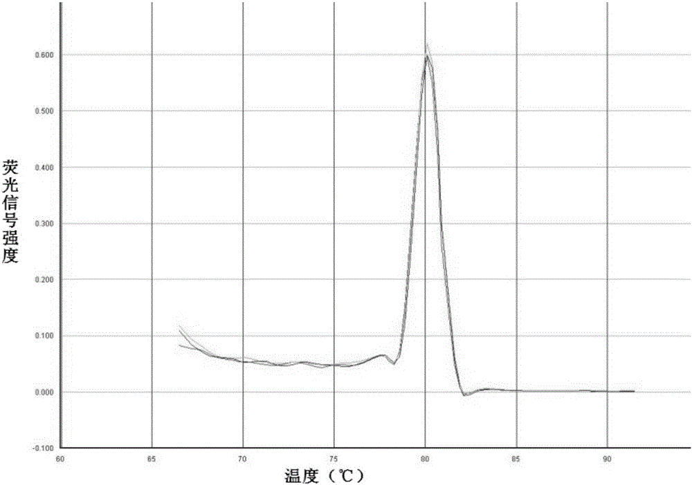 Specific primer pair for detecting expression level of human PAK2 gene and application thereof