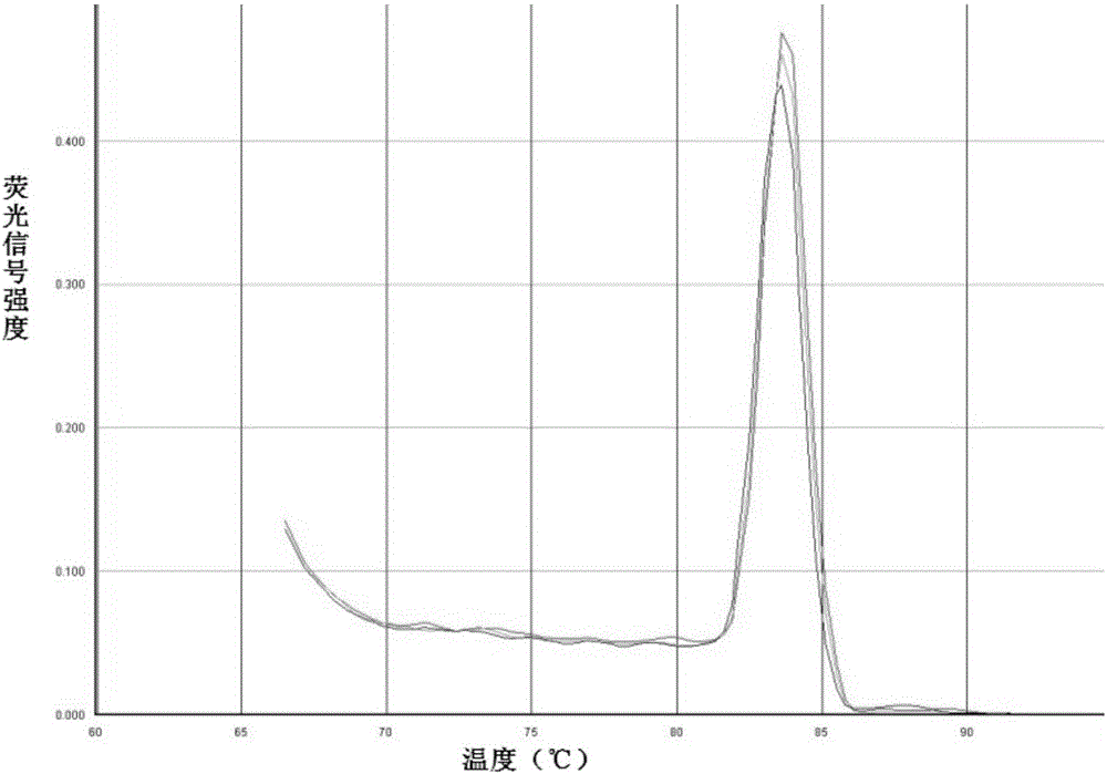 Specific primer pair for detecting expression level of human PAK2 gene and application thereof