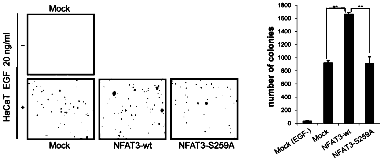 Phosphorylated nfat3 mutants and their applications