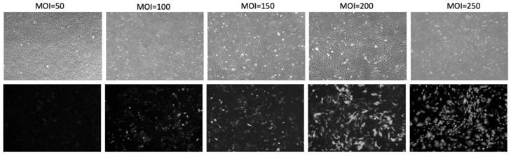 Application of reagent capable of overexpressing muscle phosphofructokinase in preparation of medicine for delaying cell senescence