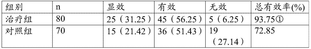 Traditional Chinese medicine preparation for treating seborrheic alopecia and preparation method thereof