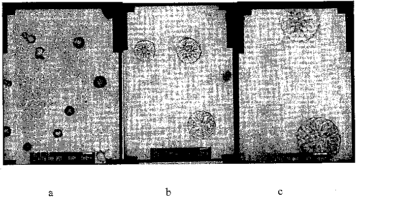 Breviscapinum long-circulating nanoliposome and its preparation method