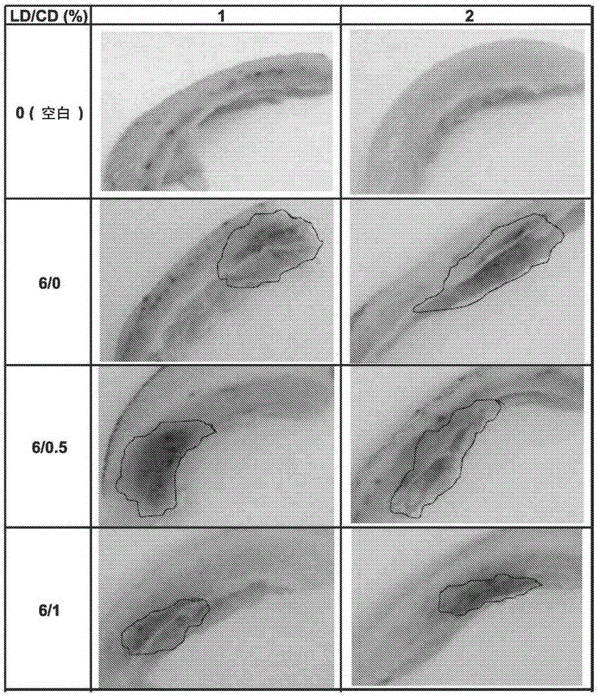 Method for treatment of Parkinson's disease