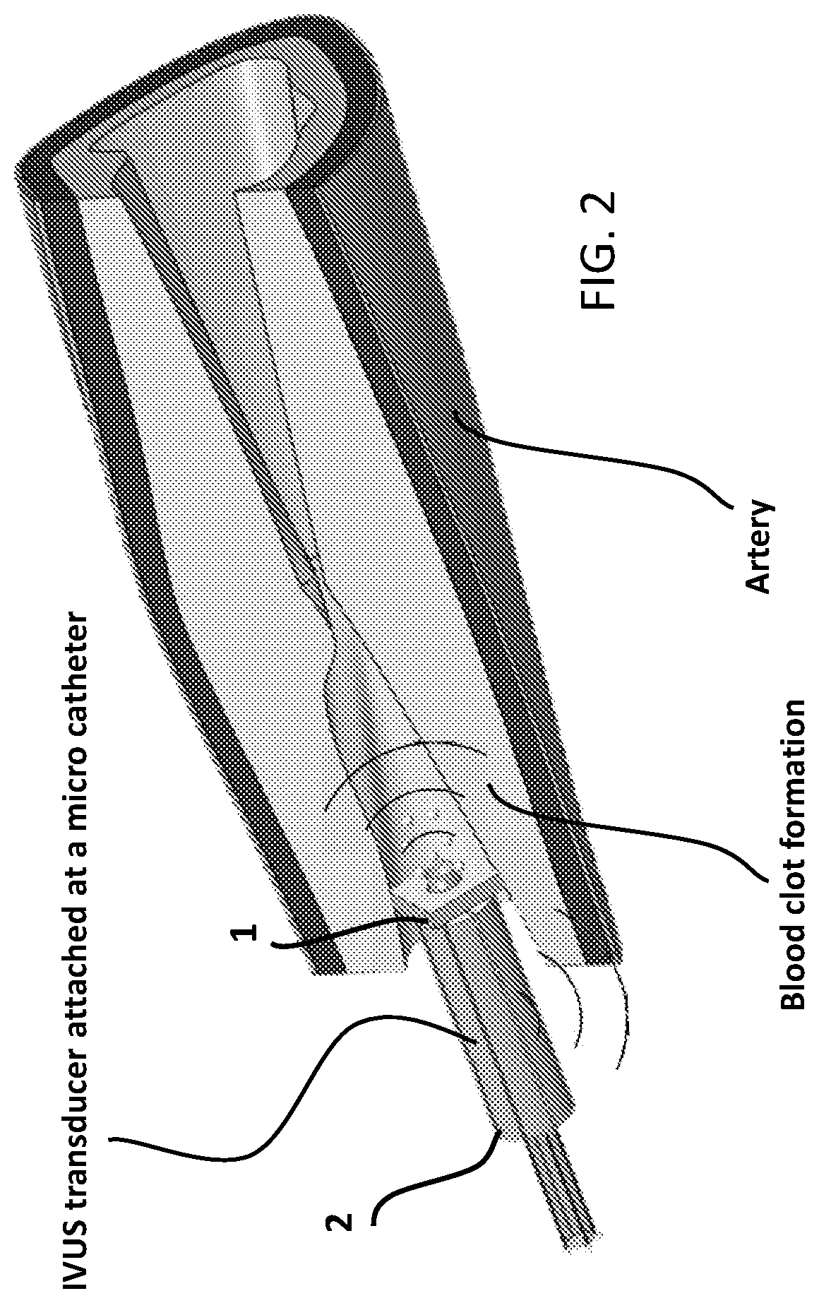 Ultrasound transducer and array for intravascular thrombolysis