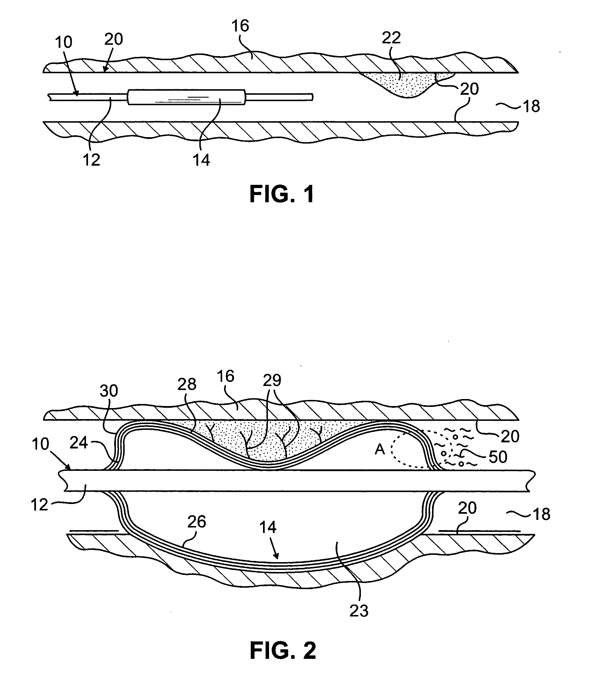 Methods and devices having electrically actuatable surfaces
