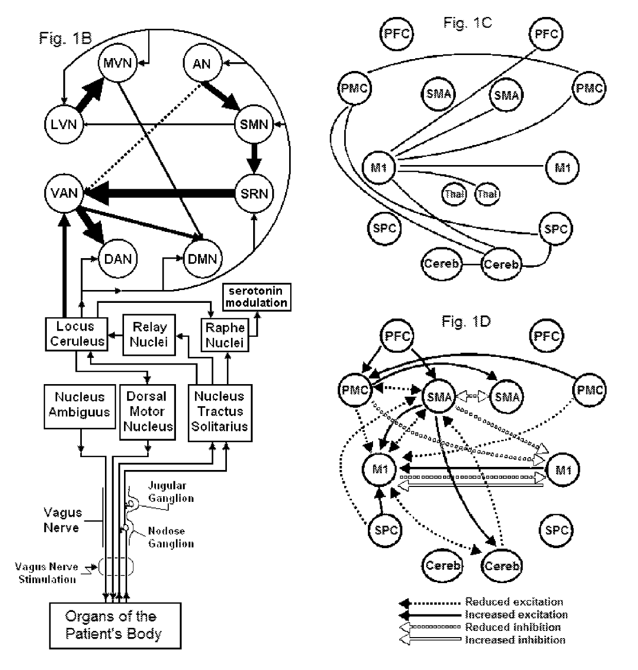 Systems and methods for vagal nerve stimulation