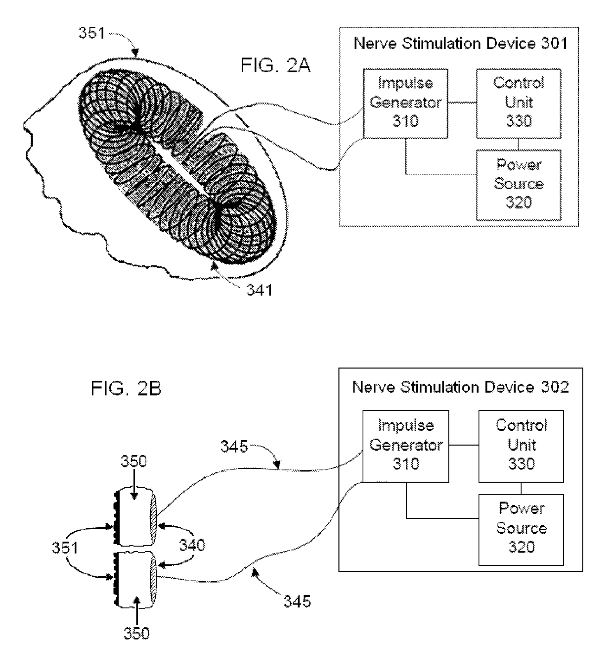 Systems and methods for vagal nerve stimulation