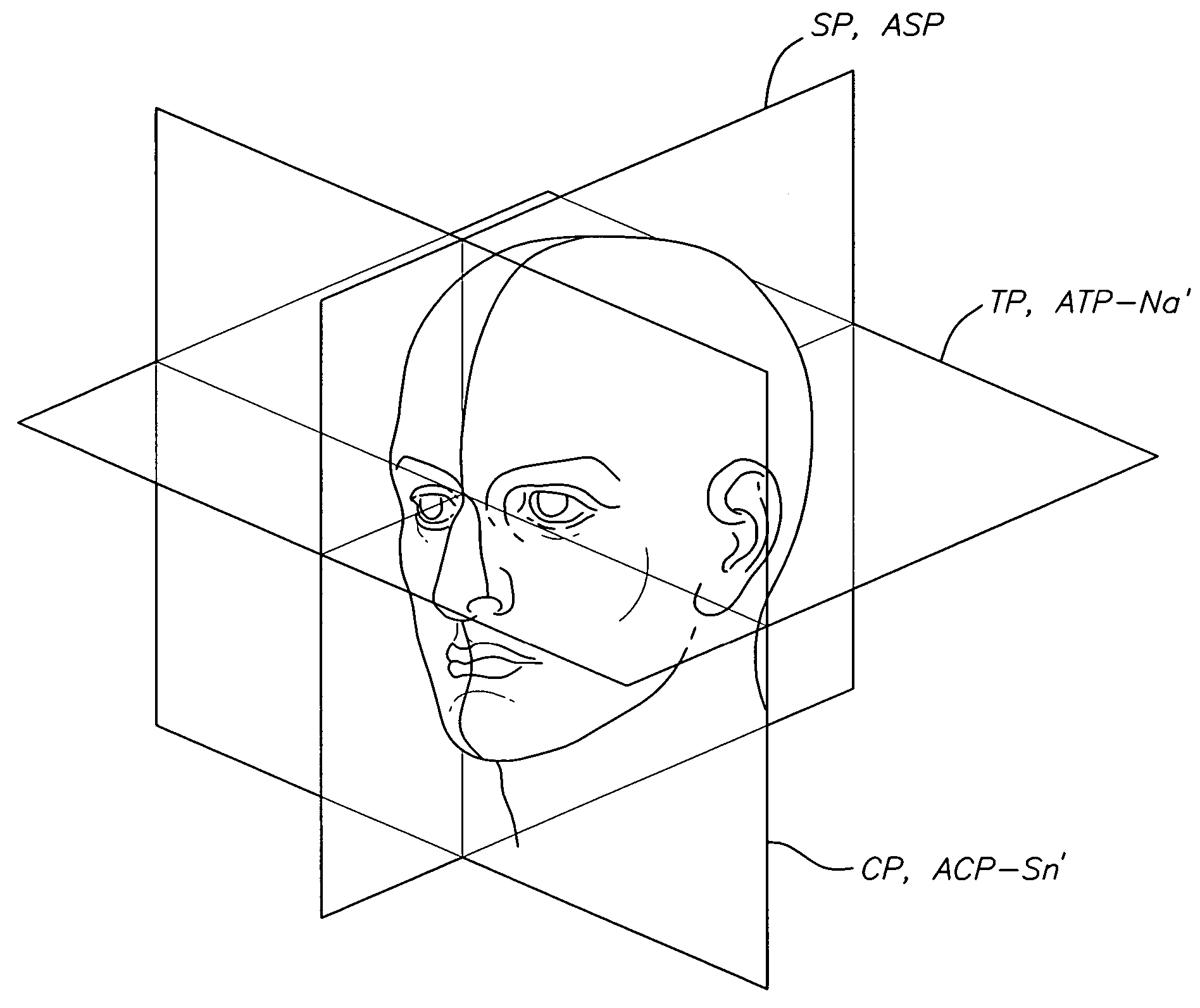 Method for determining and measuring frontal head posture and frontal view thereof