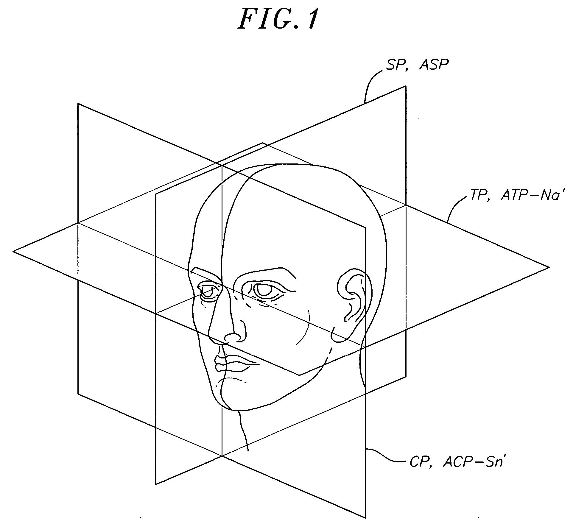 Method for determining and measuring frontal head posture and frontal view thereof