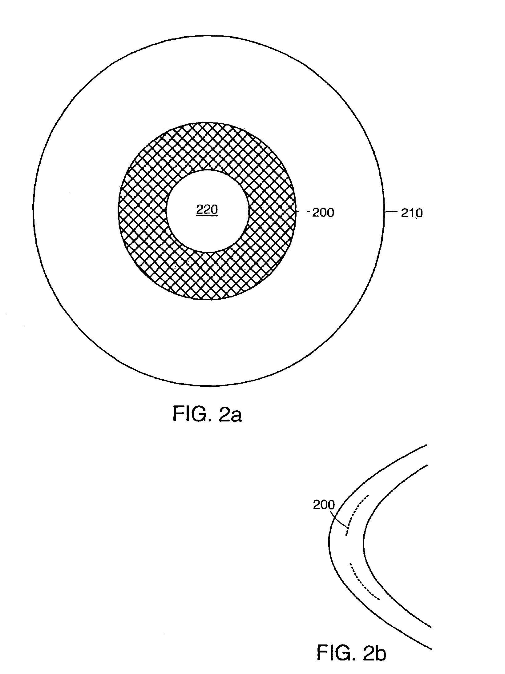 System and method for increasing the depth of focus of the human eye