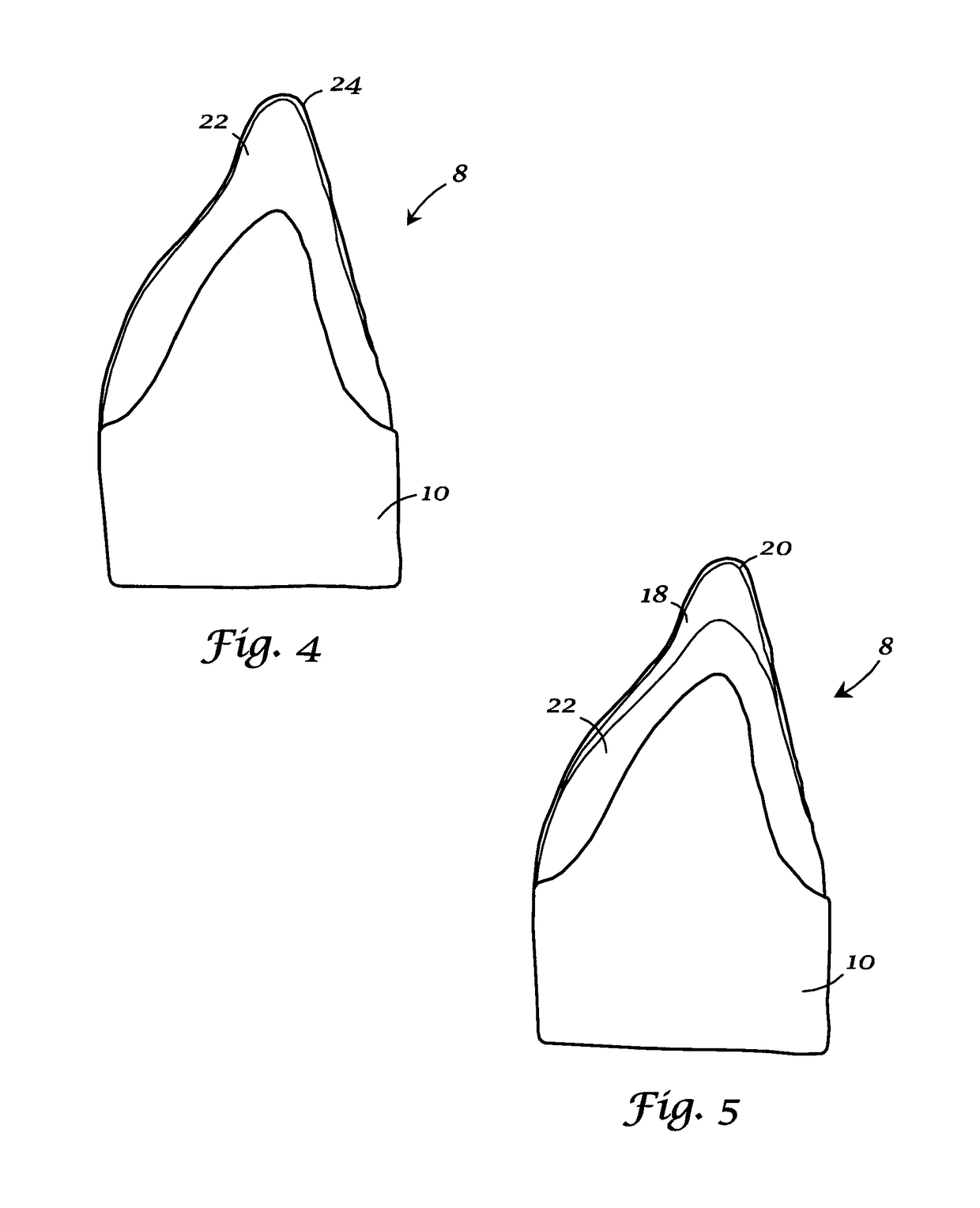 Integrated porcelain system for a dental prosthesis