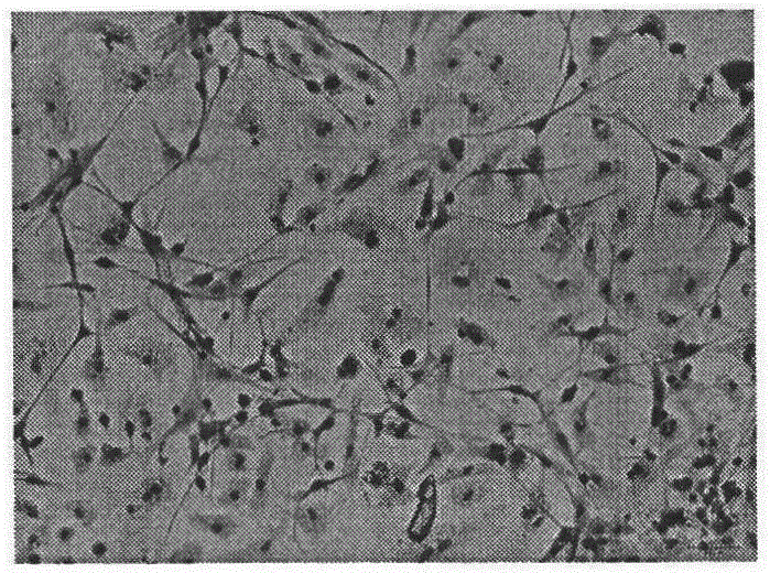 Method for separating and culturing mouse cerebellar granule cells