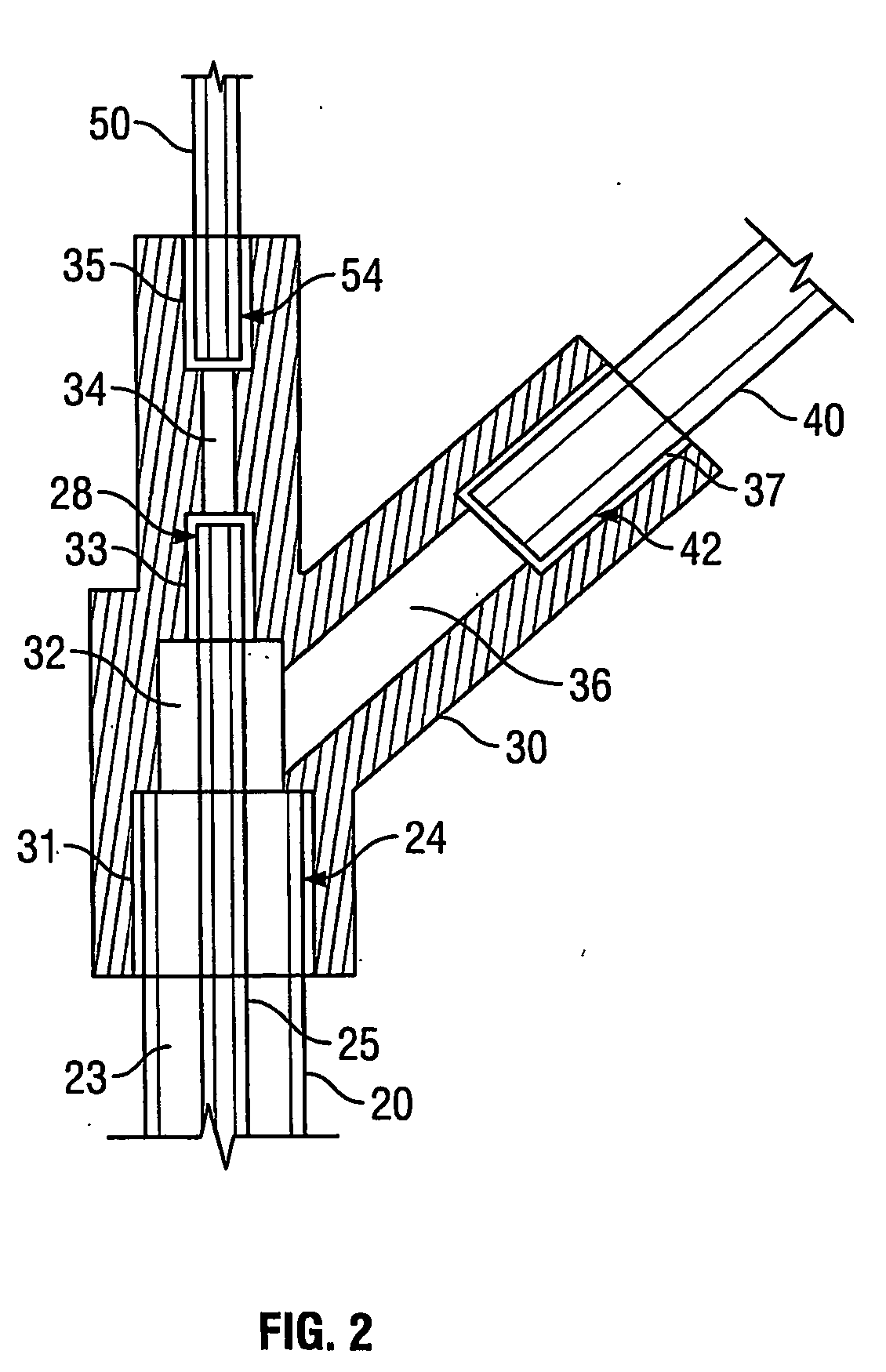 Method and Apparatus for Transnasal Ventilation