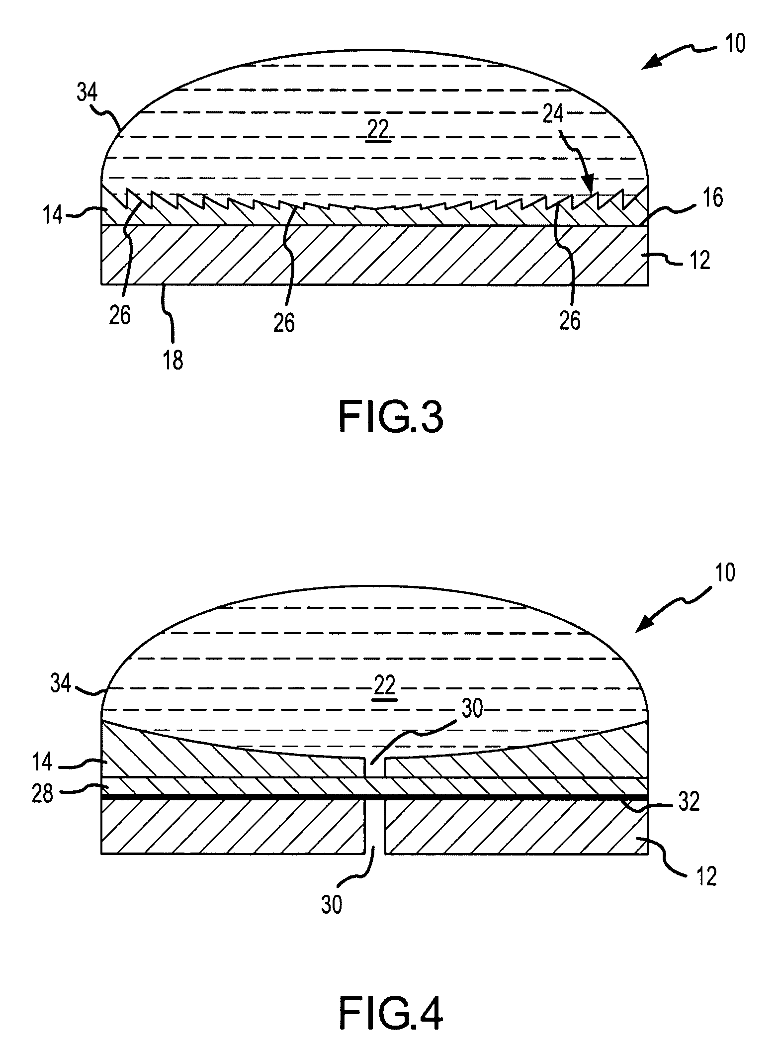 Device and method for high intensity focused ultrasound ablation with acoustic lens