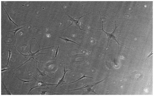 Inducer for neural differentiation of mesenchymal stem cells