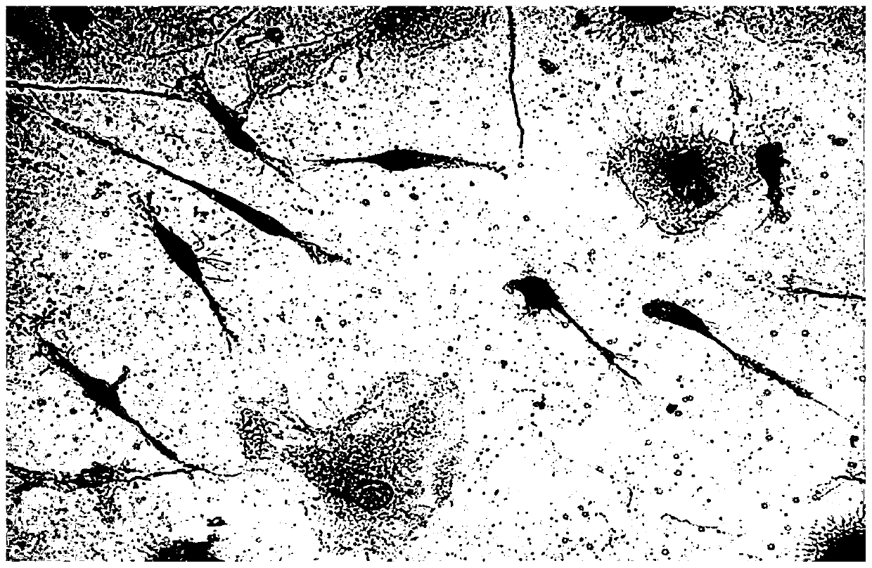 Inducer for neural differentiation of mesenchymal stem cells