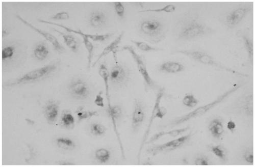 Inducer for neural differentiation of mesenchymal stem cells