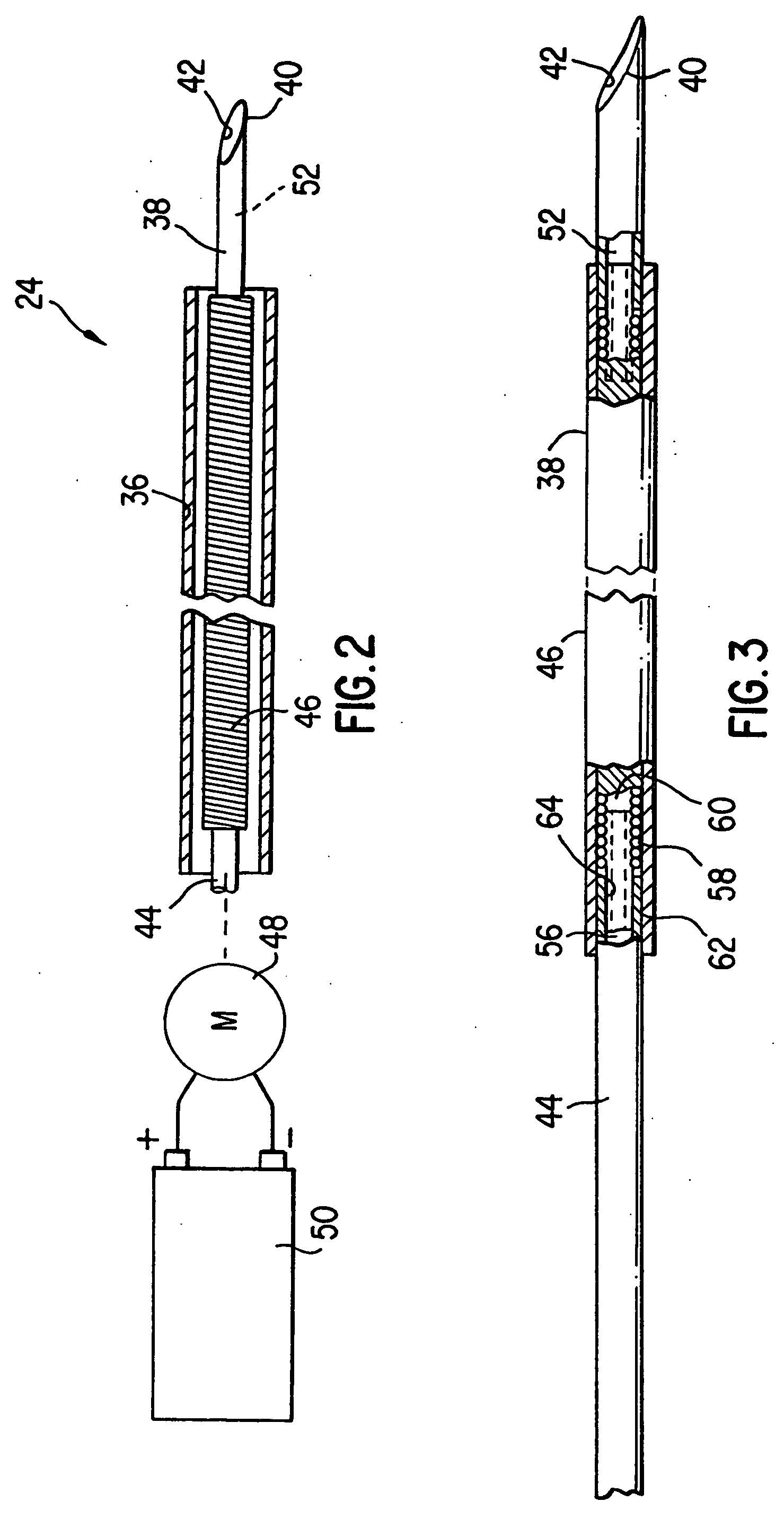 Catheter for the delivery of therapeutic agents to tissues