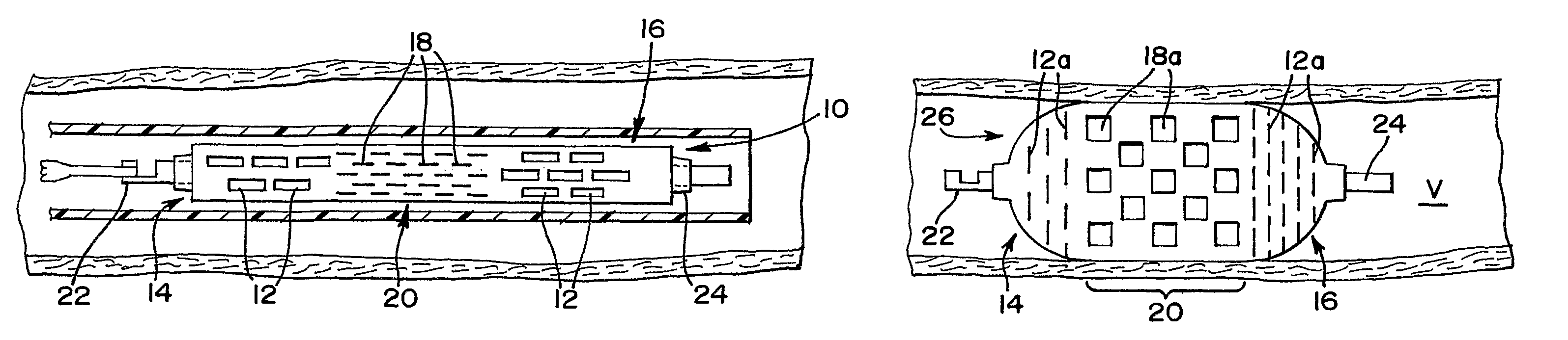 Thin film devices for temporary or permanent occlusion of a vessel