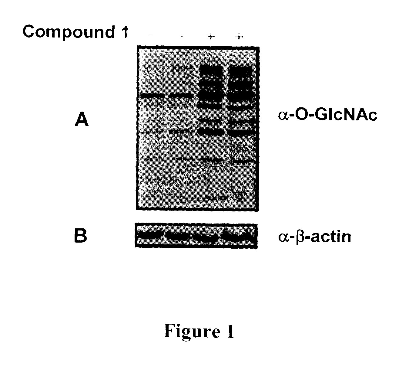 Selective Glycosidase Inhibitors and Uses Thereof