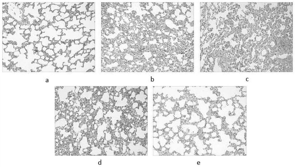 Application of Honeysuckle Petroleum Ether Extract in the Preparation of Drugs for Treating Pulmonary Fibrosis