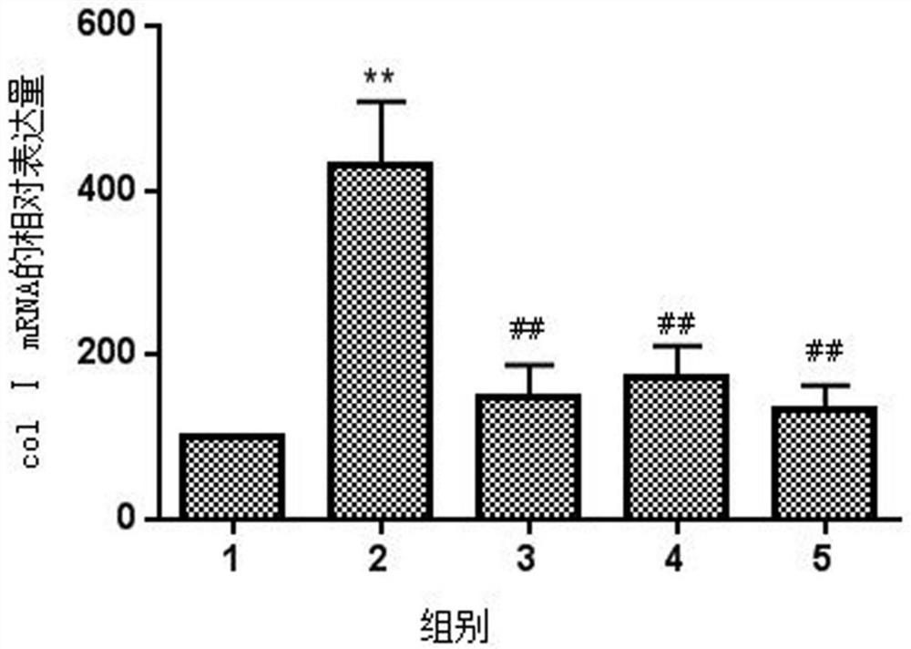 Application of Honeysuckle Petroleum Ether Extract in the Preparation of Drugs for Treating Pulmonary Fibrosis