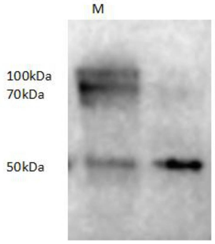 A kind of indirect ELISA detection kit and application for detecting novel chicken reovirus antibody